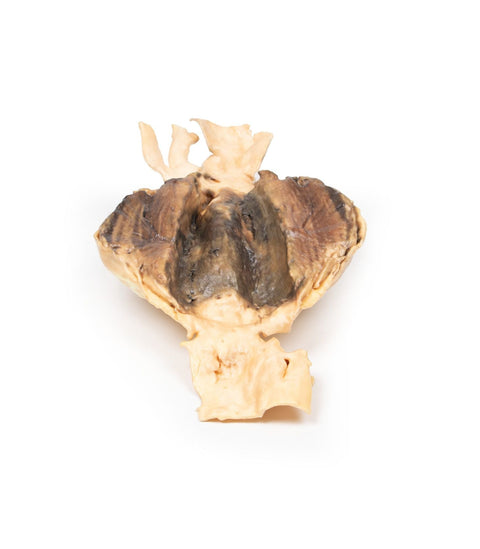 Patologie Cardiovasculara