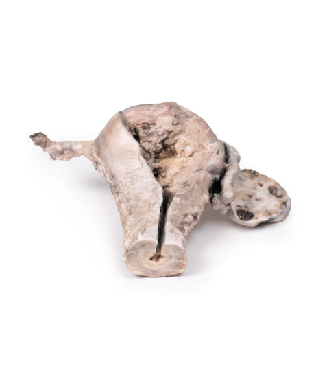 Patologie Reproductie Feminina