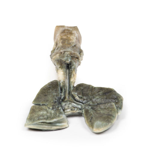 Patologie Respiratorie