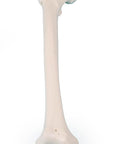 Femur