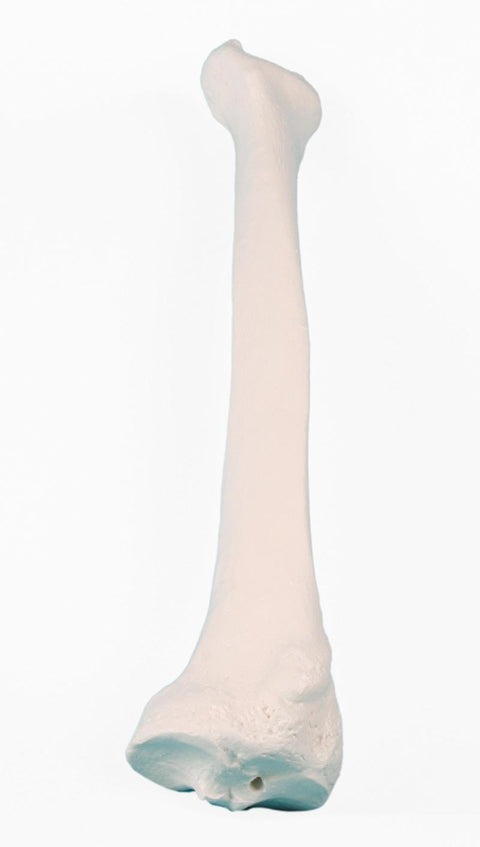 Radius