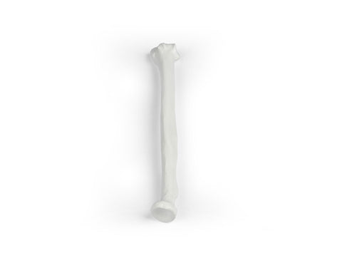 Radius