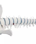 Coloană vertebrală standard cu resturi femur, prolaps și bazin