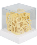 Model de comparație structură os sănătos / osteoporotic