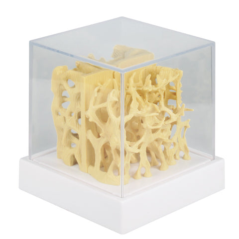 Model de comparație structură os sănătos / osteoporotic
