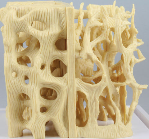 Model de comparație structură os sănătos / osteoporotic