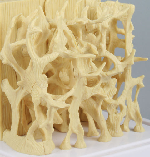 Model de comparație structură os sănătos / osteoporotic