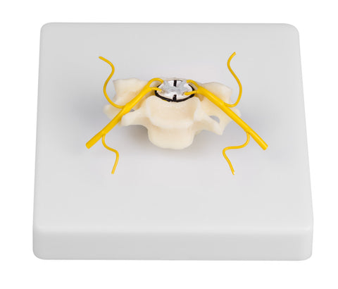 Vertebra with spinal cord section