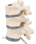 3 vertebre toracice