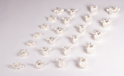 Vertebral column loose on rubber