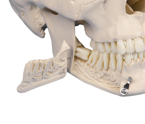Craniu dentar, 4 piese