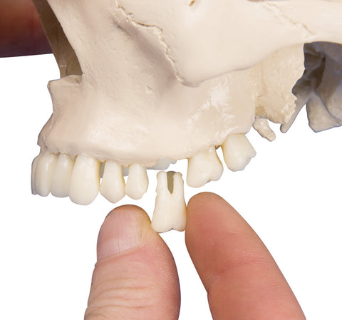 Craniu dentar, 4 piese