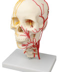 Craniu neurovascular