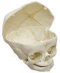 Craniu uman fetal 40 săptămâni cu calvaria tăiată