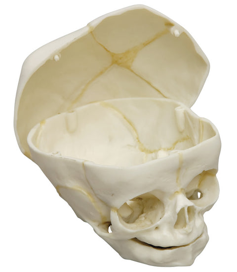 Craniu uman fetal 40 săptămâni cu calvaria tăiată