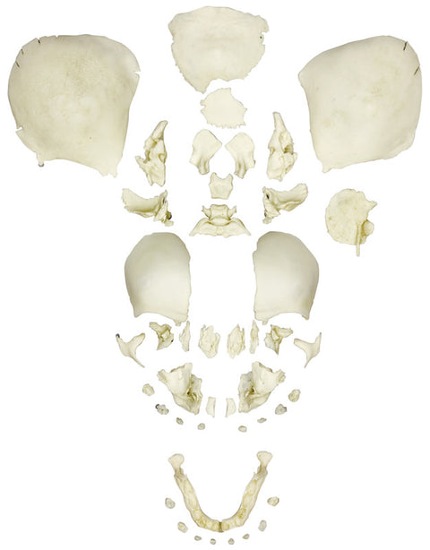 Craniu fetal uman dezarticulat, termen complet