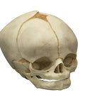 Craniu fetal 40 ½ săptămâni