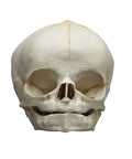 Craniu fetal 40 săptămâni