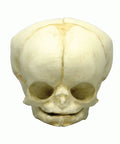 Craniu fetal 35 săptămâni