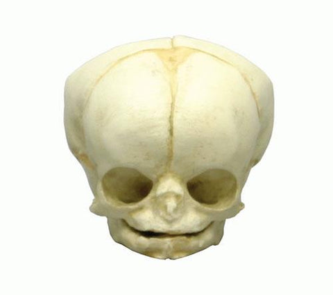 Craniu fetal 35 săptămâni