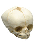 Craniu fetal 34 săptămâni