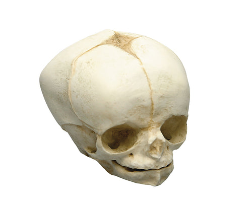 Craniu fetal 34 săptămâni