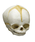 Craniu fetal 32 săptămâni