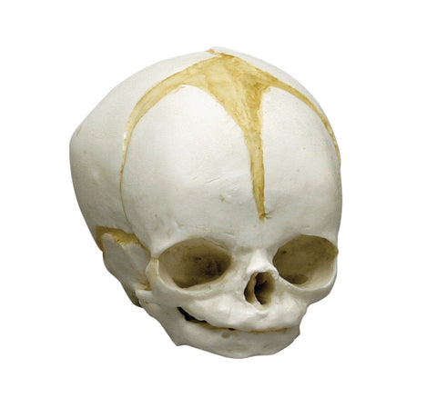 Craniu fetal 32 săptămâni