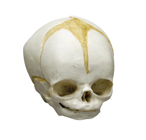 Craniu fetal 32 săptămâni