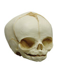 Craniu fetal 31 săptămâni