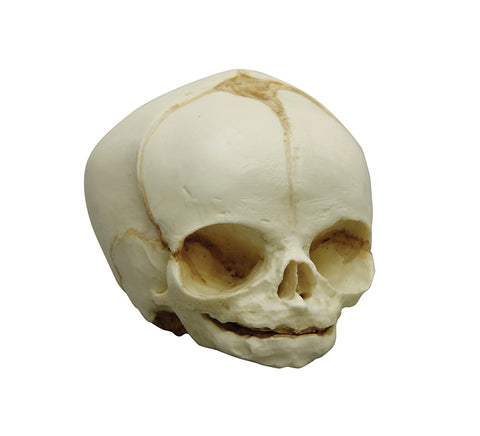 Craniu fetal 31 săptămâni