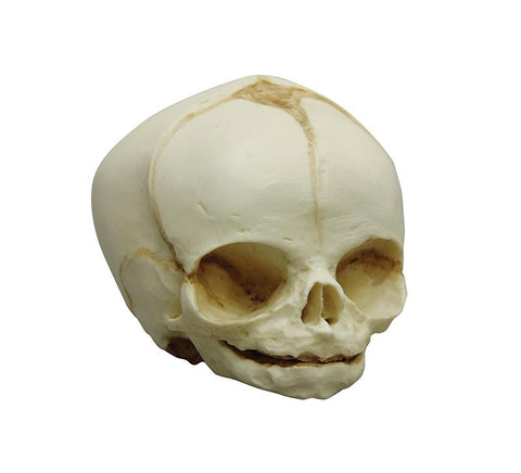 Craniu fetal 31 săptămâni