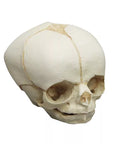 Craniu fetal 30 săptămâni