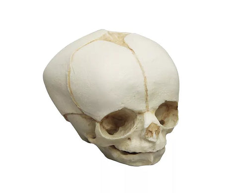 Craniu fetal 30 săptămâni