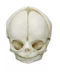 Craniu fetal 29 săptămâni