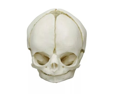 Craniu fetal 29 săptămâni