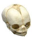 Craniu fetal 21 ½ săptămâni