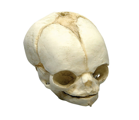 Craniu fetal 21 ½ săptămâni