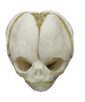 Craniu fetal 20 săptămâni