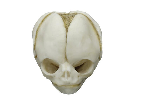 Craniu fetal 20 săptămâni