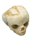 Craniu fetal 17 săptămâni