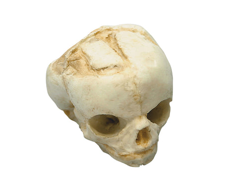 Craniu fetal 17 săptămâni
