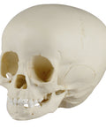 Craniu de copil, 1 ½ ani