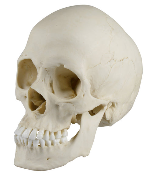 Craniu scafocefalic