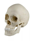 Craniu scafocefalic