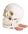 Model de craniu pentru stomatologie cu sindrom de disfuncție temporomandibulară, 8 piese