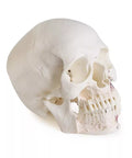 Model de craniu pentru stomatologie cu sindrom de disfuncție temporomandibulară, 8 piese