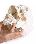 Model de craniu pentru stomatologie cu sindrom de disfuncție temporomandibulară, 8 piese