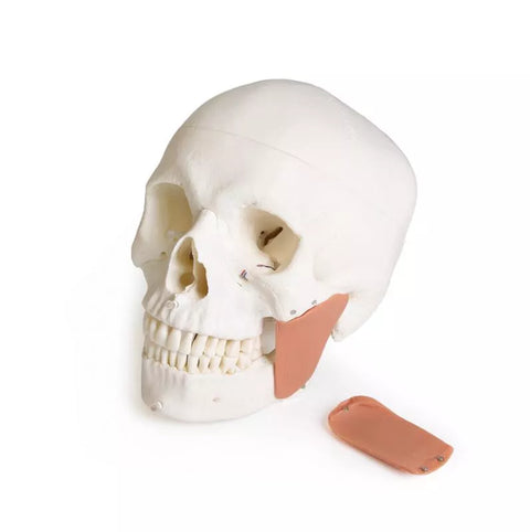 Model de craniu pentru stomatologie cu sindrom de disfuncție temporomandibulară, 8 piese