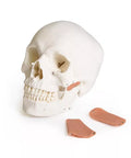 Model de craniu pentru stomatologie cu sindrom de disfuncție temporomandibulară, 8 piese